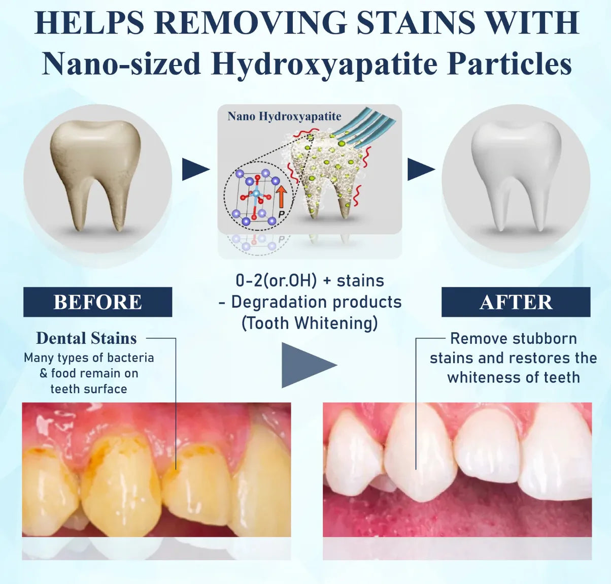 BioEnamel Tooth Armor Drops — Restores Enamel, Protects Against Cavities and Sensitivity, Whitens Teeth, and Eliminates Bad Breath