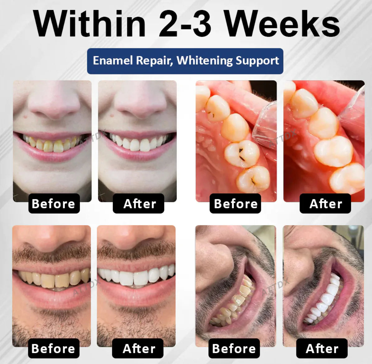 BioEnamel Tooth Armor Drops — Restores Enamel, Protects Against Cavities and Sensitivity, Whitens Teeth, and Eliminates Bad Breath