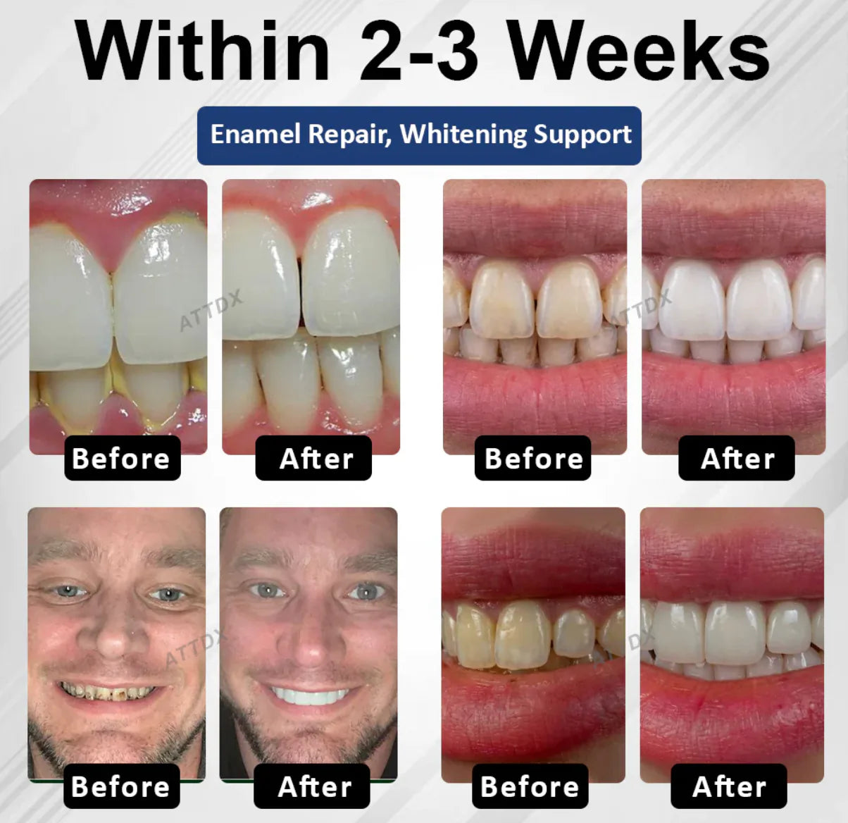 BioEnamel Tooth Armor Drops — Restores Enamel, Protects Against Cavities and Sensitivity, Whitens Teeth, and Eliminates Bad Breath