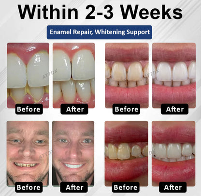 BioEnamel Tooth Armor Drops — Restores Enamel, Protects Against Cavities and Sensitivity, Whitens Teeth, and Eliminates Bad Breath